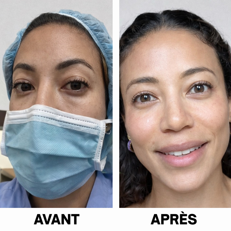 GLORÉYA PARIS - Patch Anti-Cernes