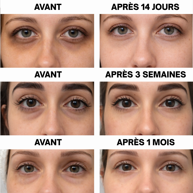 GLORÉYA PARIS - Patch Anti-Cernes