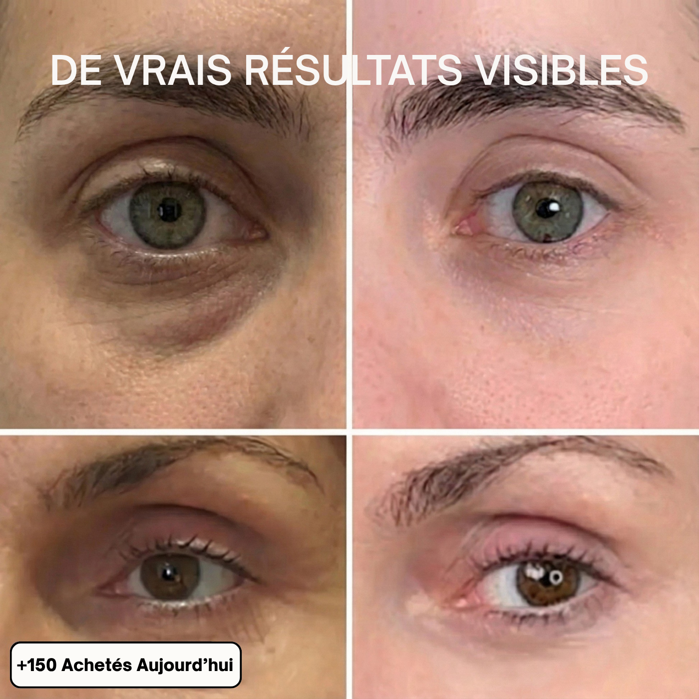 Baume Anti-Rides & Anti-Cernes au Calcium