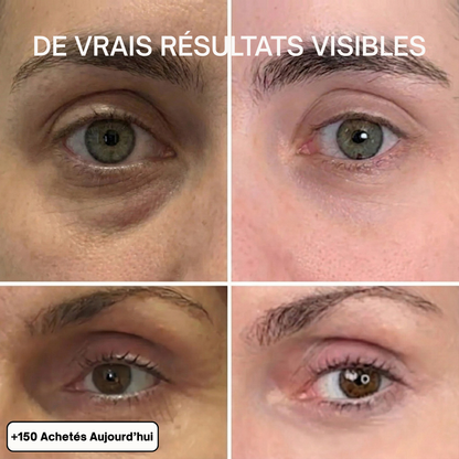 Baume Anti-Rides & Anti-Cernes au Calcium