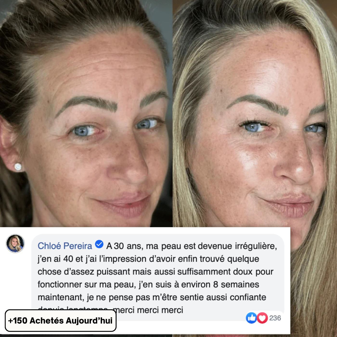Baume Anti-Rides & Anti-Cernes au Calcium