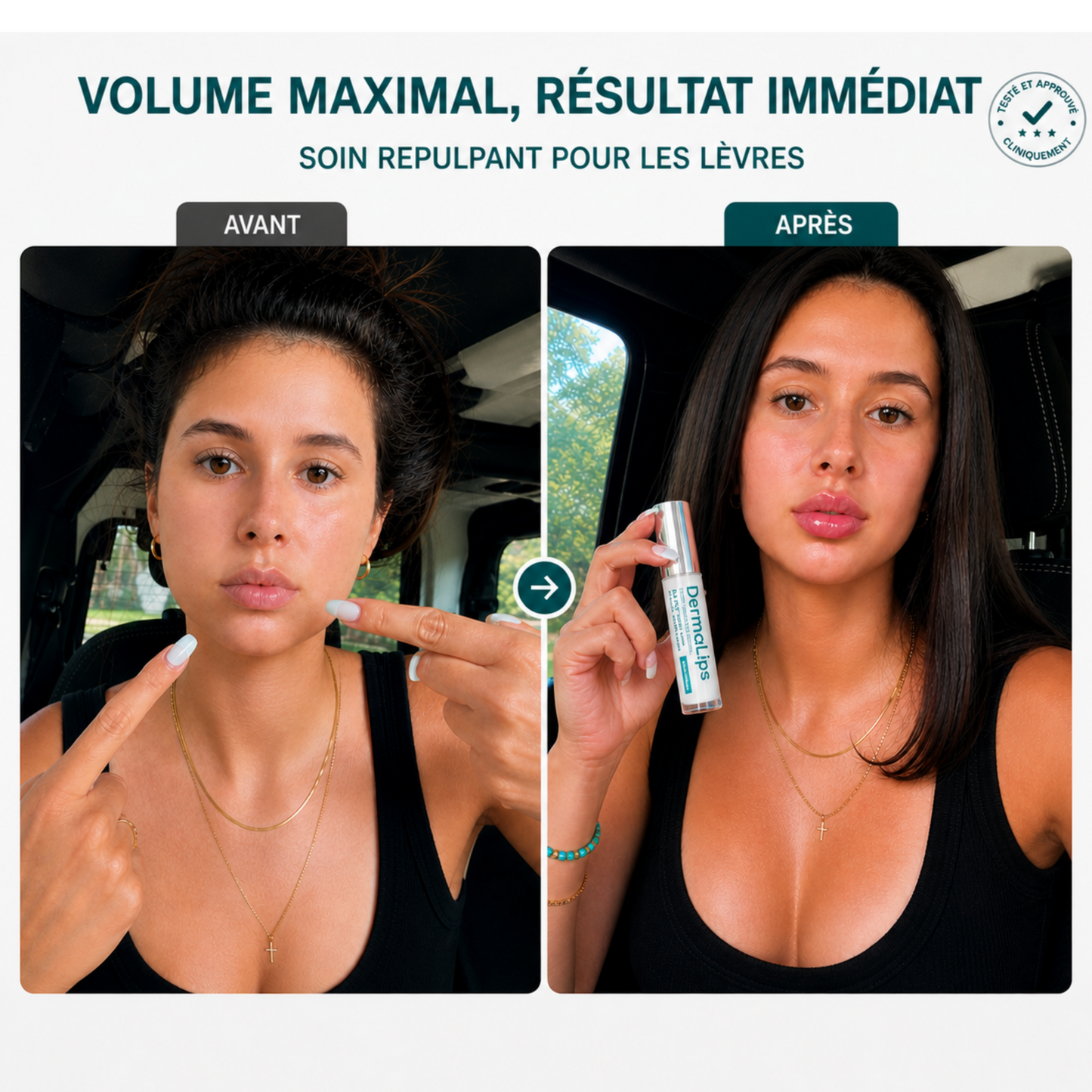 DermaLips - Gloss Repulpant (Effet Immédiat)